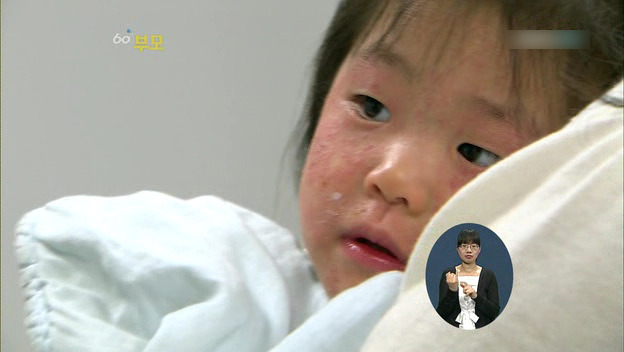 [60분부모] 아토피가 아이의 자존감을 낮춘다 ① | 인스티즈