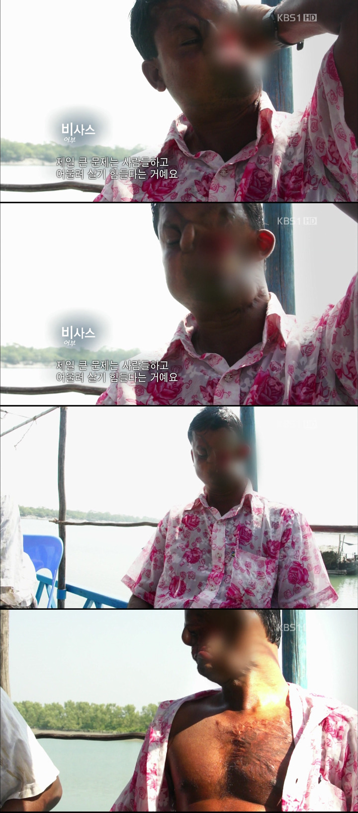 약혐)호랑이에게 공격당한 사람.jpg | 인스티즈