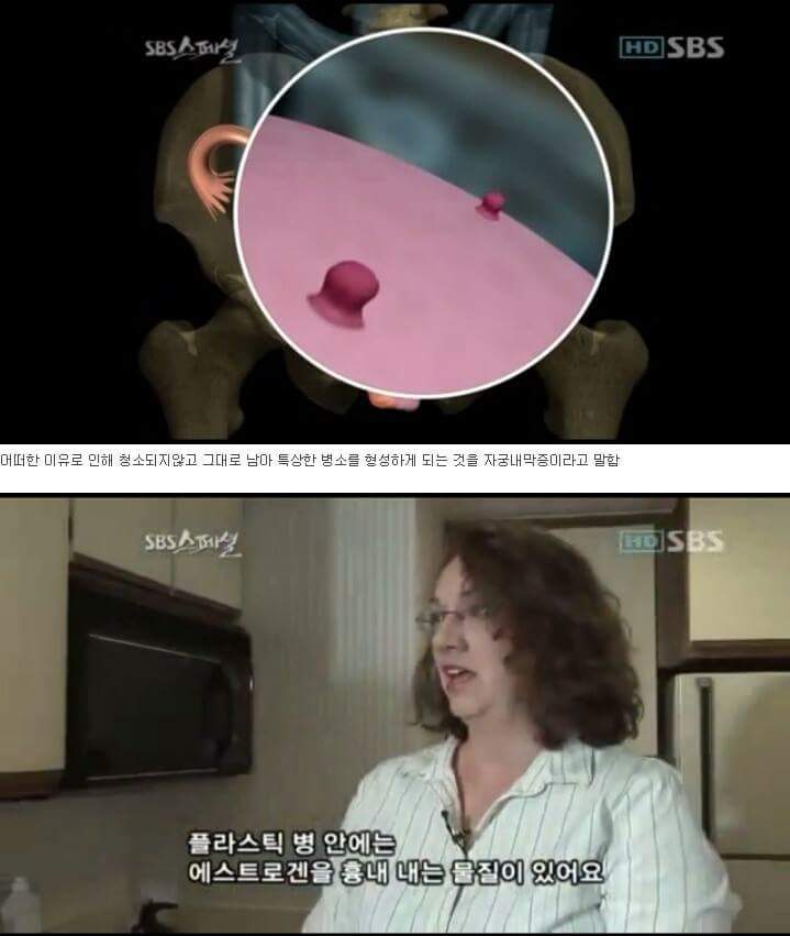뿌쉈다 고쳤다 지잣대로하는 잣같은 생리통의 원인 | 인스티즈