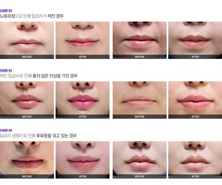 사람 인상에서 은근히 많이 차지하는거 | 인스티즈