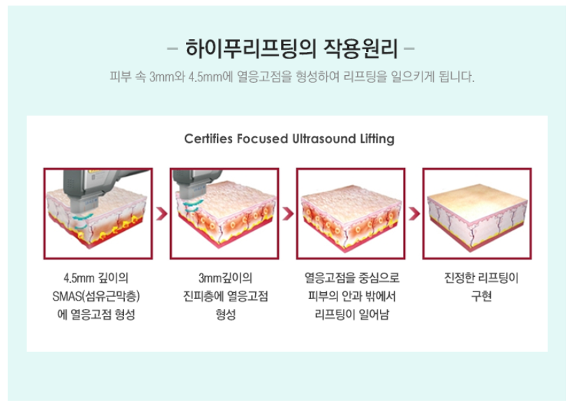 미사랑 이미지
