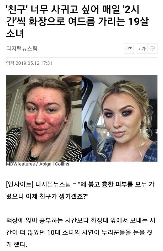 여드름 때문에 하루 2시간 화장하는 소녀 | 인스티즈