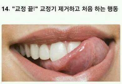 교정한 사람들은 공감하는것 | 인스티즈