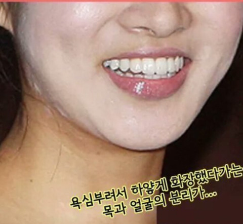 몸매 기준만큼 엄격한 "좋은 피부"에 대한 강박관념 | 인스티즈